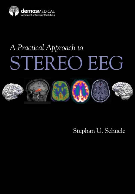 Practical Approach to Stereo EEG