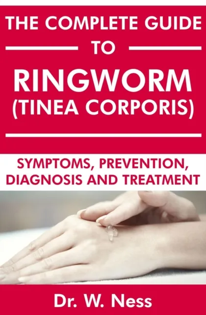 Complete Guide to Ringworm (Tinea Corporis): Symptoms, Prevention, Diagnosis and Treatment