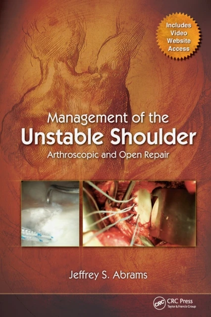 Management of the Unstable Shoulder