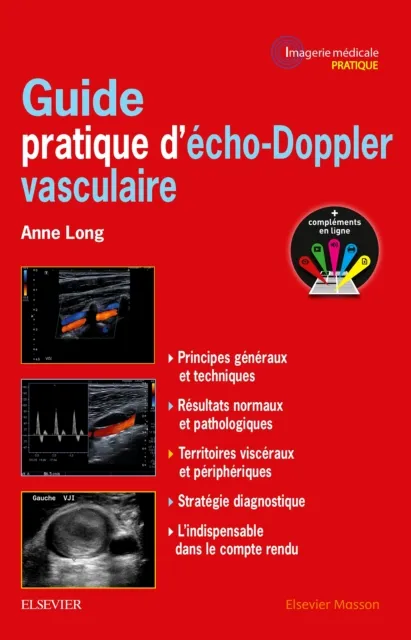 Guide pratique d'echo-Doppler vasculaire