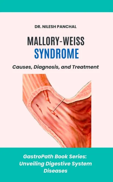 Mallory-Weiss Syndrome: Causes, Diagnosis, and Treatment