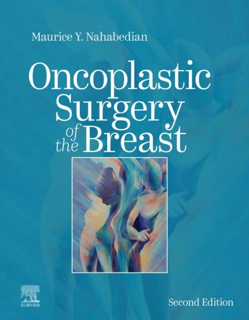 Oncoplastic Surgery of the Breast E-Book