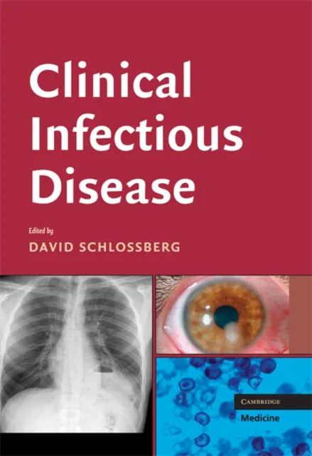 Clinical Infectious Disease