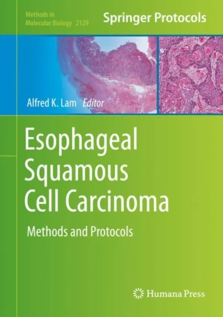Esophageal Squamous Cell Carcinoma