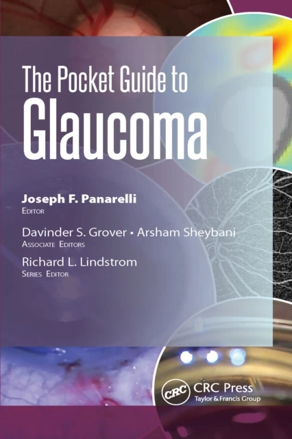 Pocket Guide to Glaucoma