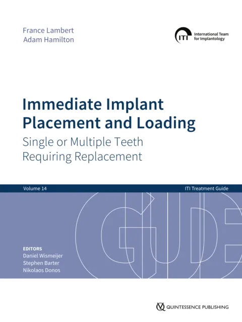 Immediate Implant Placement and Loading - Single or Multiple Teeth Requiring Replacement