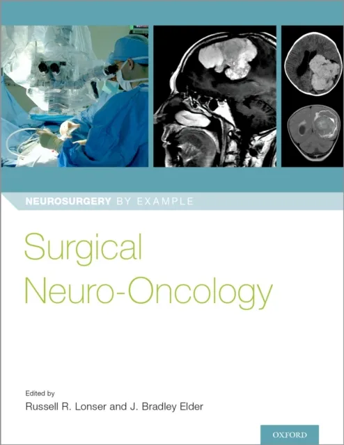 Surgical Neuro-Oncology