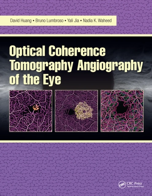 Optical Coherence Tomography Angiography of the Eye