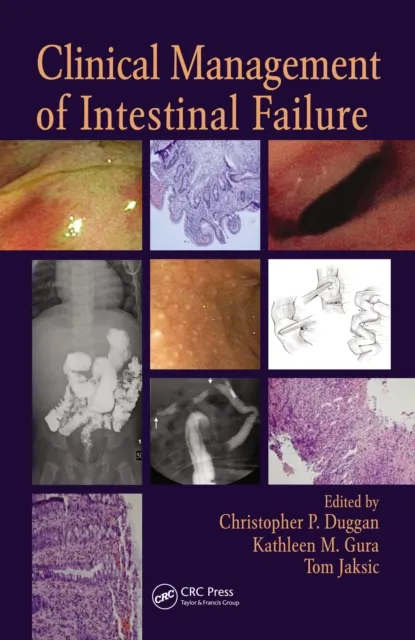 Clinical Management of Intestinal Failure