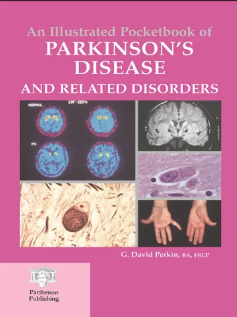Illustrated Pocketbook of Parkinson's Disease and Related Disorders