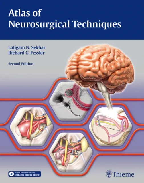 Atlas of Neurosurgical Techniques