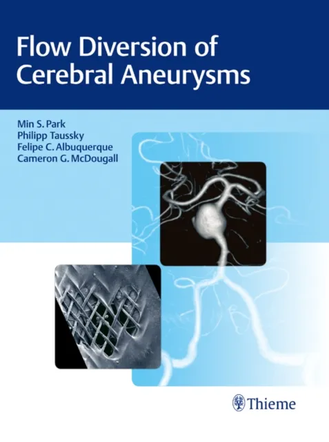Flow Diversion of Cerebral Aneurysms