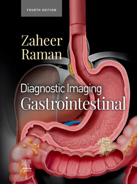 Diagnostic Imaging: Gastrointestinal - E-Book