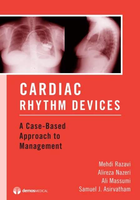 Cardiac Rhythm Devices