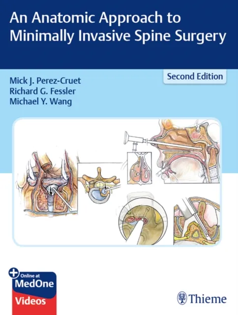 Anatomic Approach to Minimally Invasive Spine Surgery
