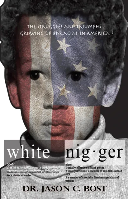 White Nigger: The Struggles and Triumphs Growing up Bi-Racial in America