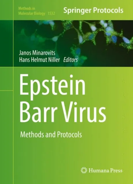 Epstein Barr Virus