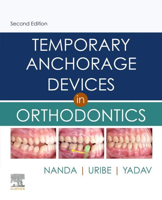 Temporary Anchorage Devices in Orthodontics E-Book