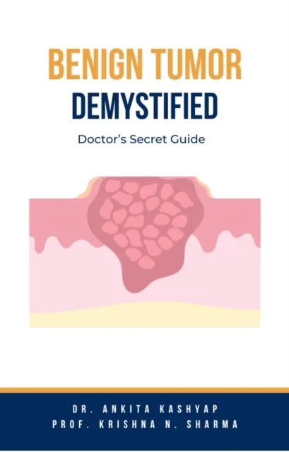 Benign Tumor Demystified: Doctor's Secret Guide