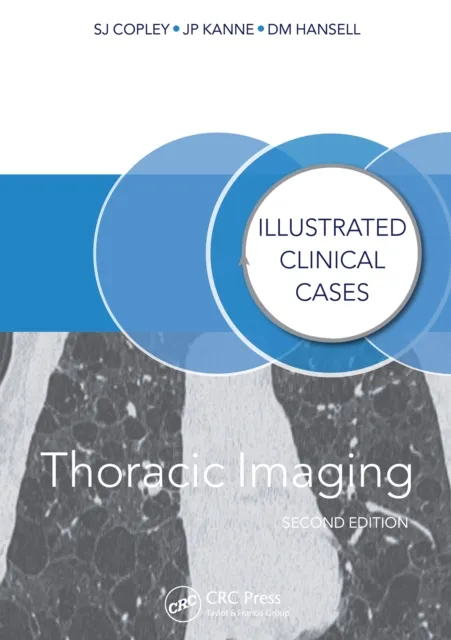 Thoracic Imaging