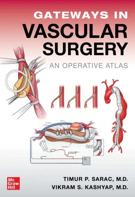 Gateways in Vascular Surgery: An Operative Atlas
