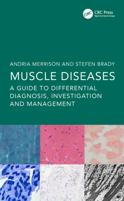 Muscle Diseases