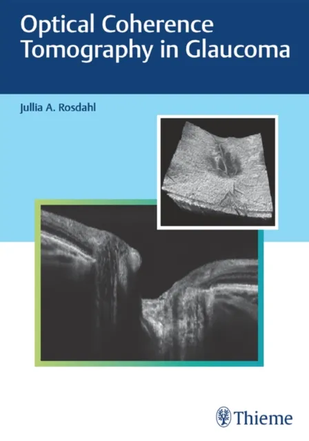 Optical Coherence Tomography in Glaucoma