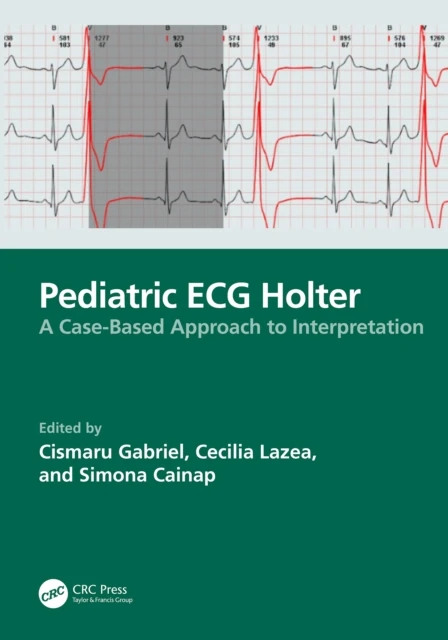 Pediatric ECG Holter