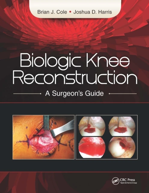 Biologic Knee Reconstruction