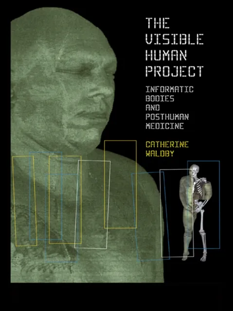 Visible Human Project