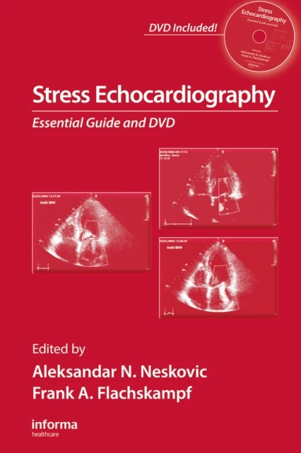 Stress Echocardiography