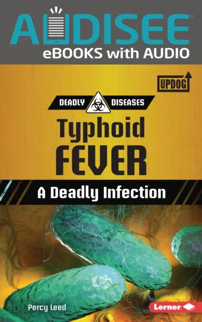 Typhoid Fever