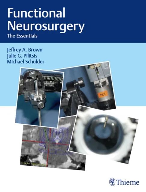 Functional Neurosurgery