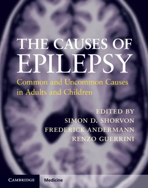 Causes of Epilepsy