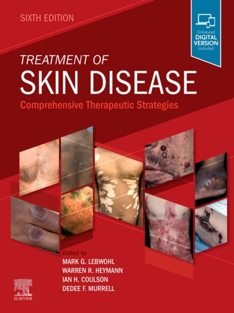 Treatment of Skin Disease E-Book