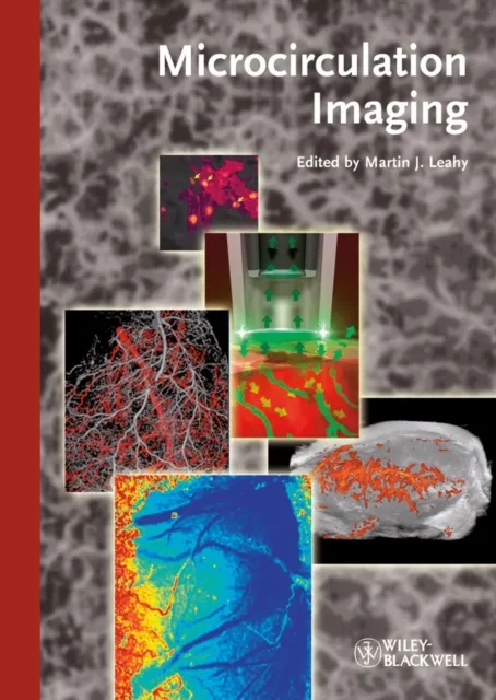 Microcirculation Imaging