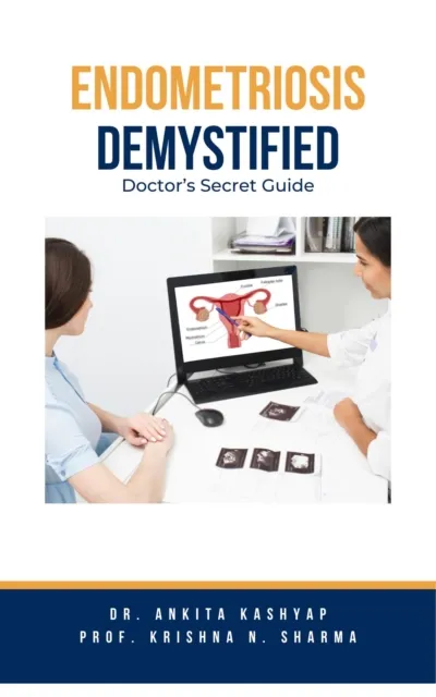 Endometriosis Demystified: Doctor's Secret Guide