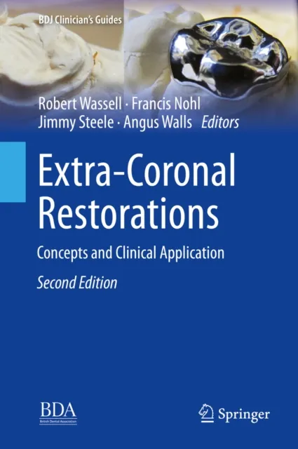 Extra-Coronal Restorations