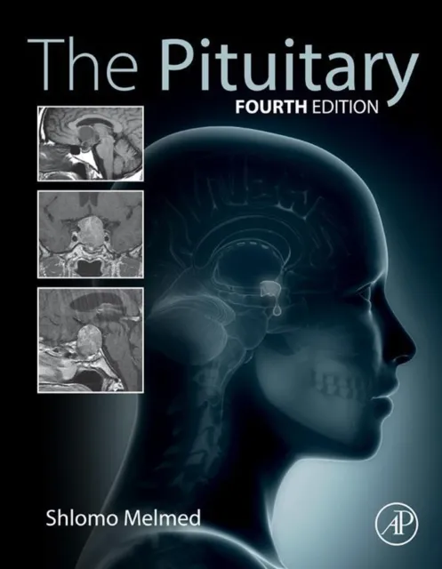 Pituitary
