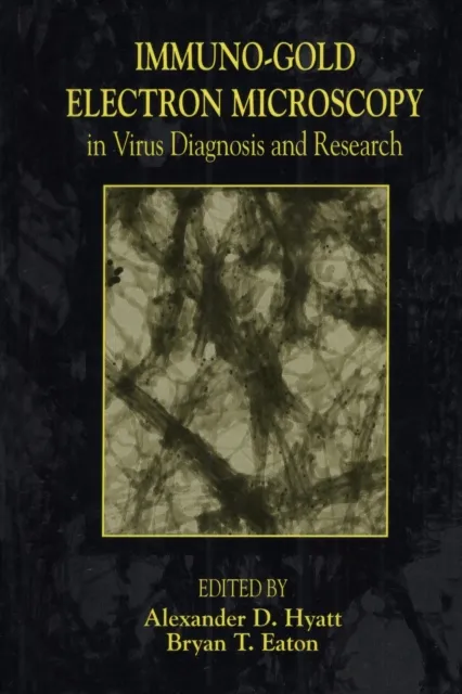 Immuno-Gold Electron Microscopy in Virus Diagnosis and Research