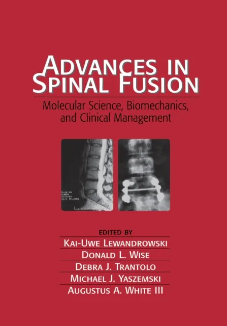 Advances in Spinal Fusion