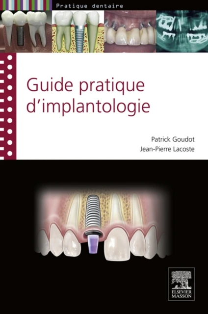 guide pratique d'implantologie