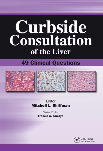 Curbside Consultation of the Liver