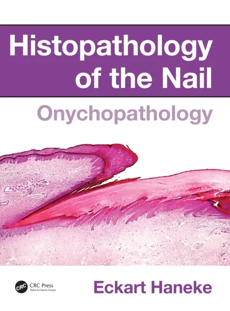 Histopathology of the Nail