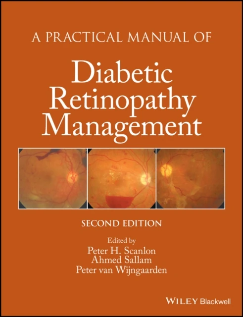 Practical Manual of Diabetic Retinopathy Management