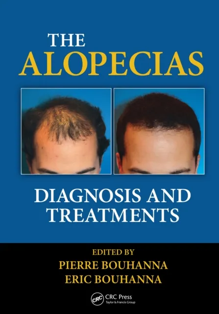 Alopecias