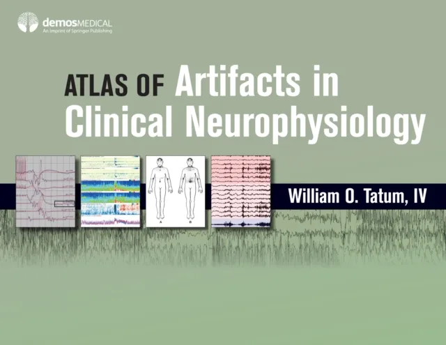 Atlas of Artifacts in Clinical Neurophysiology