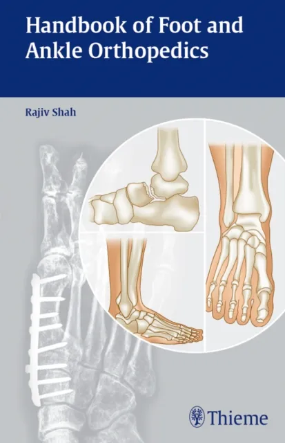 Handbook of Foot and Ankle Orthopedics