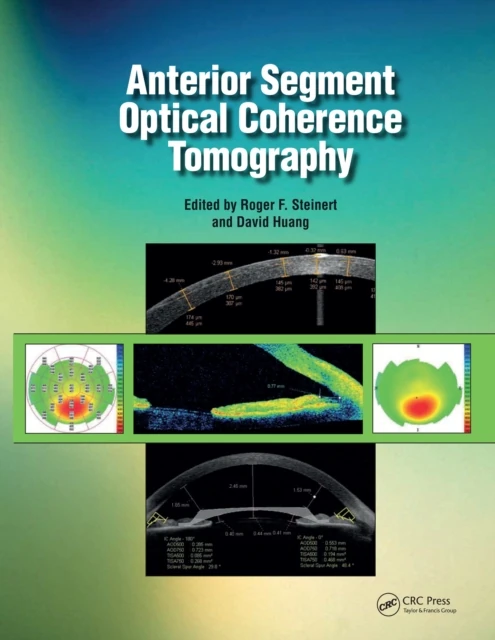 Anterior Segment Optical Coherence Tomography