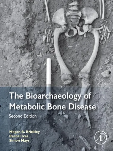 Bioarchaeology of Metabolic Bone Disease